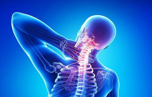 bolovi u vratu s osteohondrozom