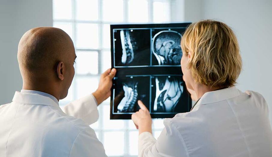 dijagnostika cervikalne osteohondroze slikama