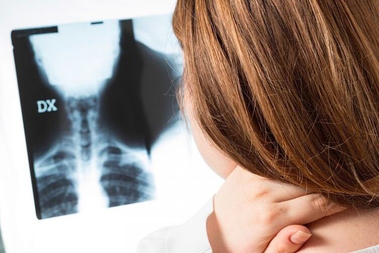 X -Ray regije grlića maternice