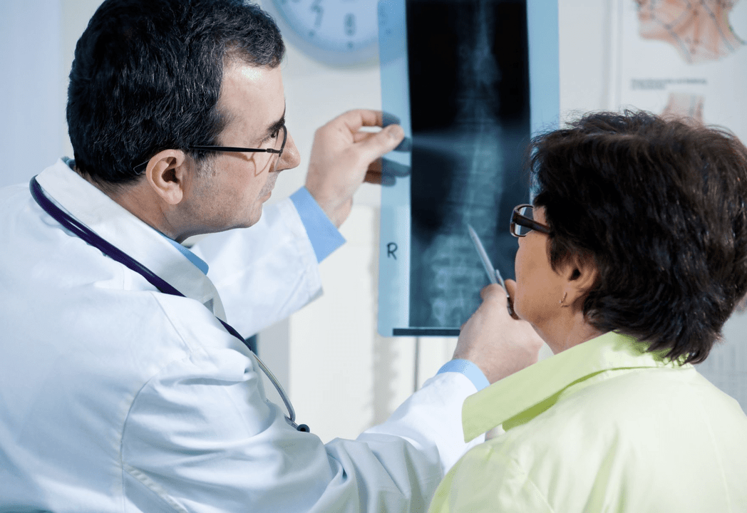 Neurolog dijagnosticira osteohondrozu pomoću radiografije kralježnice
