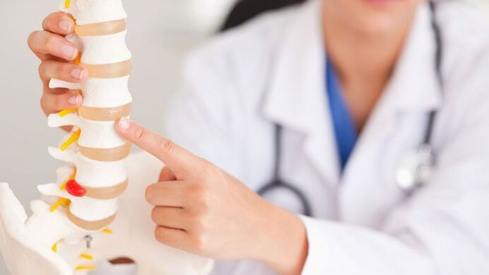 objašnjenje lumbalne osteohondroze na modelu kralježnice